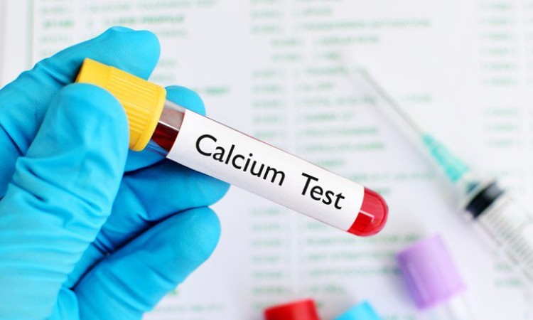 Định lượng Canxi trong máu để làm gì ?