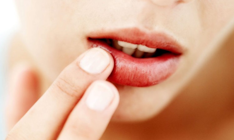 XÓA TAN NỔI LO NỨT NẺ MÔI VÀO MÙA ĐÔNG